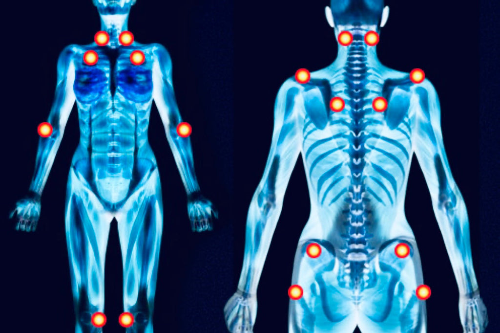 Fibromyalgia/Chronic Fatigue Syndrome & EVOO - Blog #17