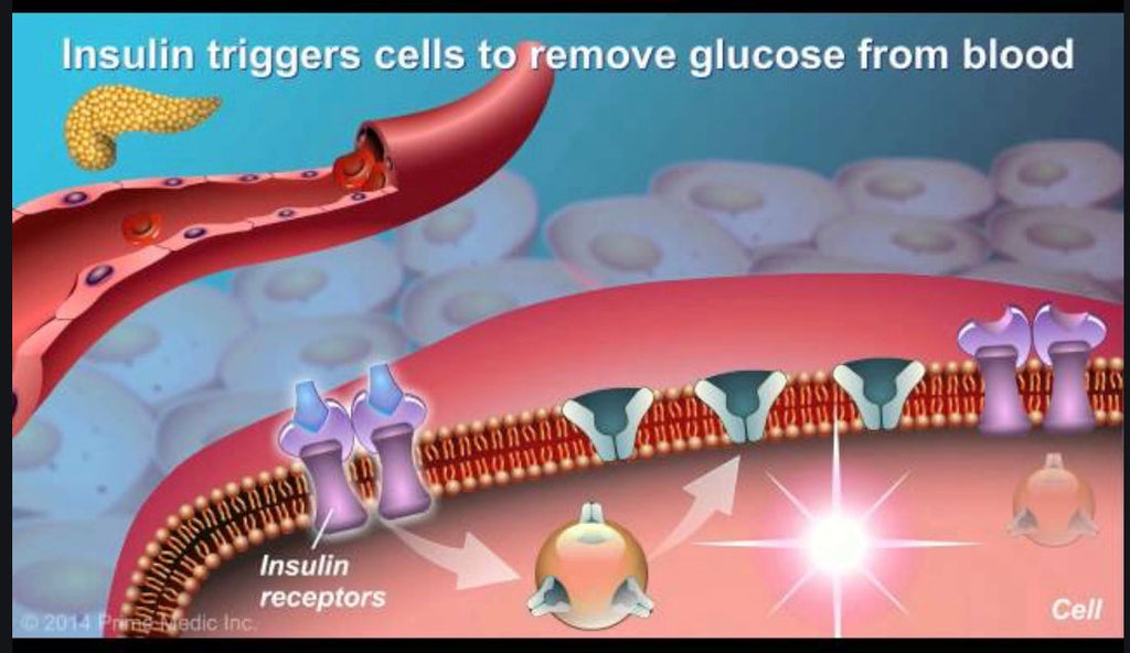 Can I Prevent Type 2 Diabetes? - Blog # 48