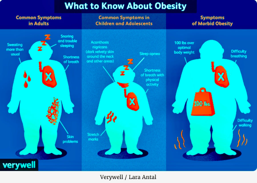 Obesity: Why Can’t I Lose Weight? - Blog # 58