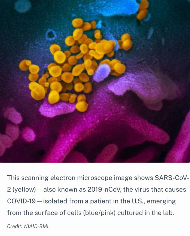 Can I Prevent SARS-CoV-2 Infection? - Blog # 52