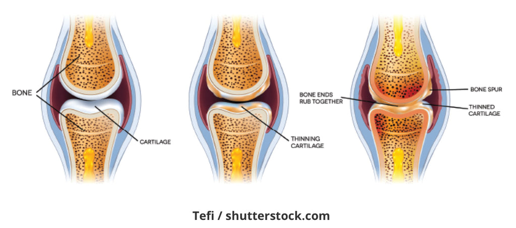Our Knees and EVOO - Blog # 39