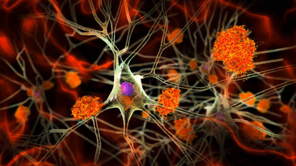 Alzheimer’s Dementia and HP-EVOO - Blog # 67