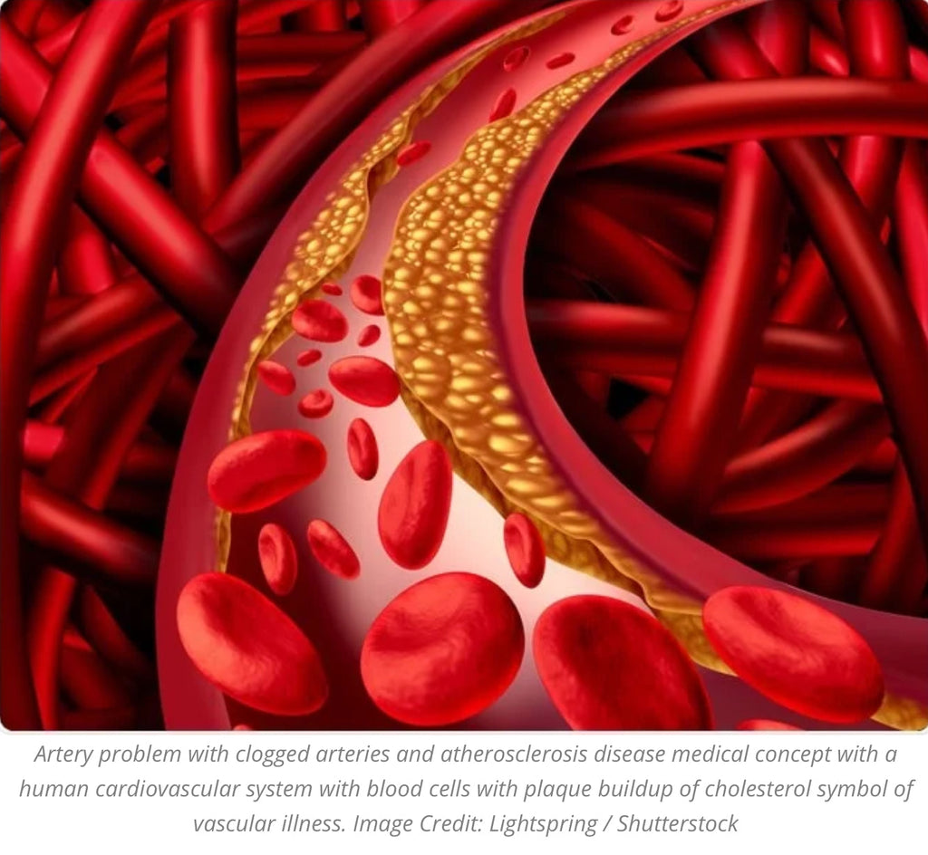 Cholesterol: Good? Bad? Should I worry? - Blog # 44