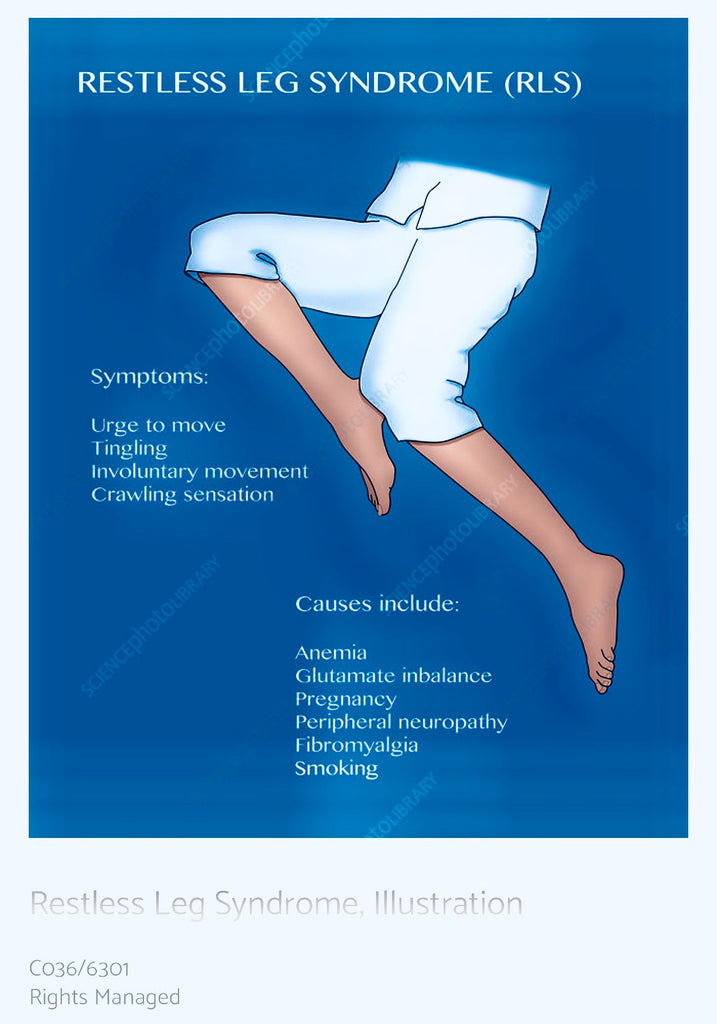 Restless Leg Syndrome and EVOO - Blog # 18