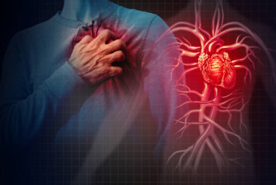 Cardiovascular Disease, Heart Attacks & Importance of Nitric Oxide #HP-EVOO - Blog # 92