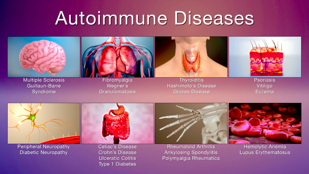 The Rise Of Autoimmune Diseases #HP-EVOO - Blog # 97